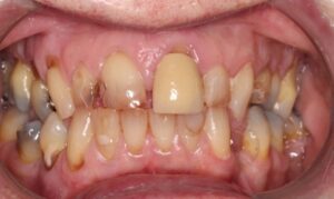 JS Before